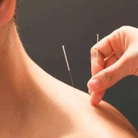 Acuity Acupuncture